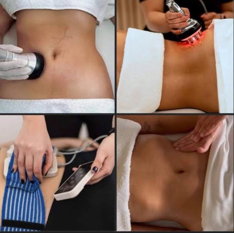 Tratamiento corporal(reductivo, flacidez, anticelulitis)